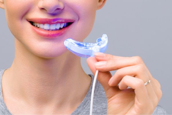 6 mýtov domáceho bielenia zubov