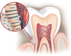 Citlivosť pri bielení zubov