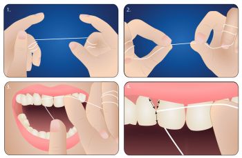 Správna technika použitia zubnej nite vás ušetrí od poranenia a zaistí vám kvalitné odstránenie zubného povlaku z medzizubných priestorov.