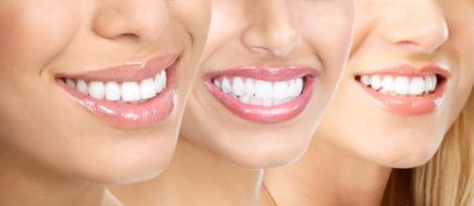 Bieliť si zuby doma je jeden z najrýchlejších, najpohodlnejších a najdostupnejších spôsobov ako získať biely úsmev. 
