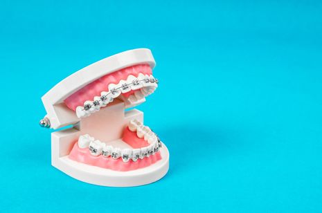 bielenie zubov po zubnom strojčeku